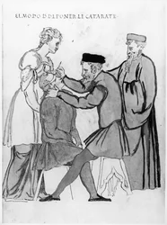 Eye Surgery to Remove Cataracts